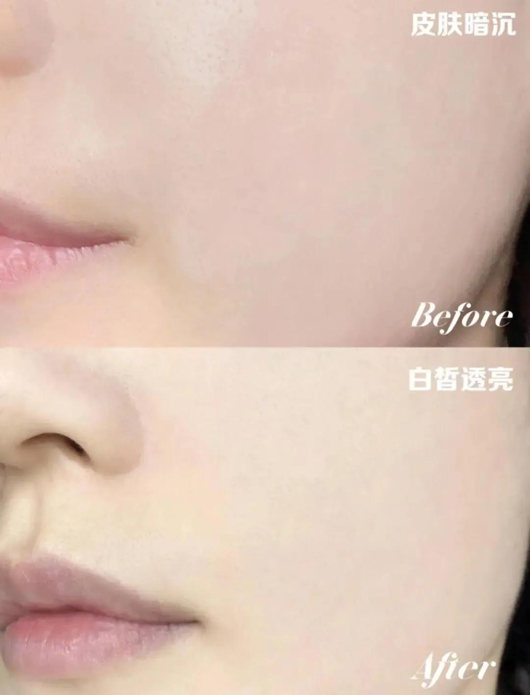 低成本黄黑皮美白,黑黄皮美白最快的产品