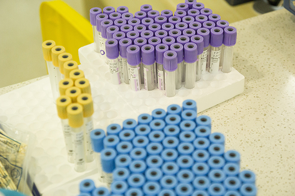 被误诊艾滋病可以报警吗,误诊了艾滋病有什么症状