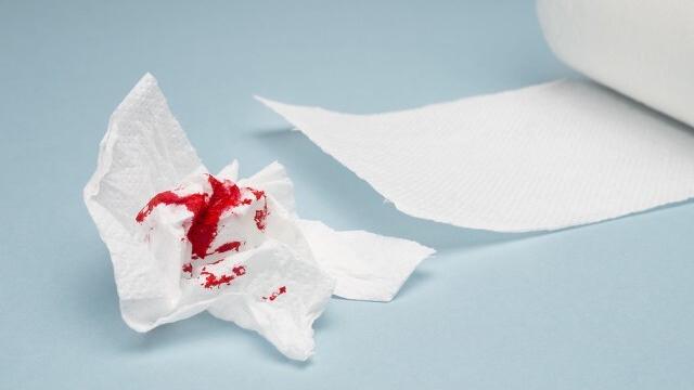 痔疮便血和肛裂便血的区别,女性痔疮肛裂便血左下腹疼