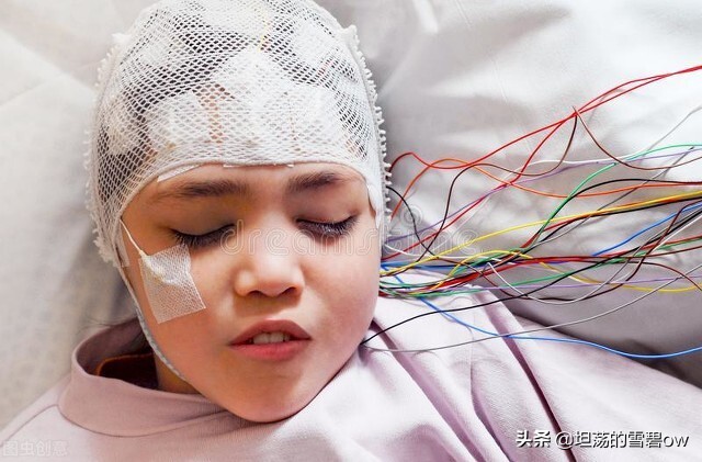小孩高烧抽搐惊厥为什么查脑部,孩子发烧抽搐翻白眼诱发癫痫