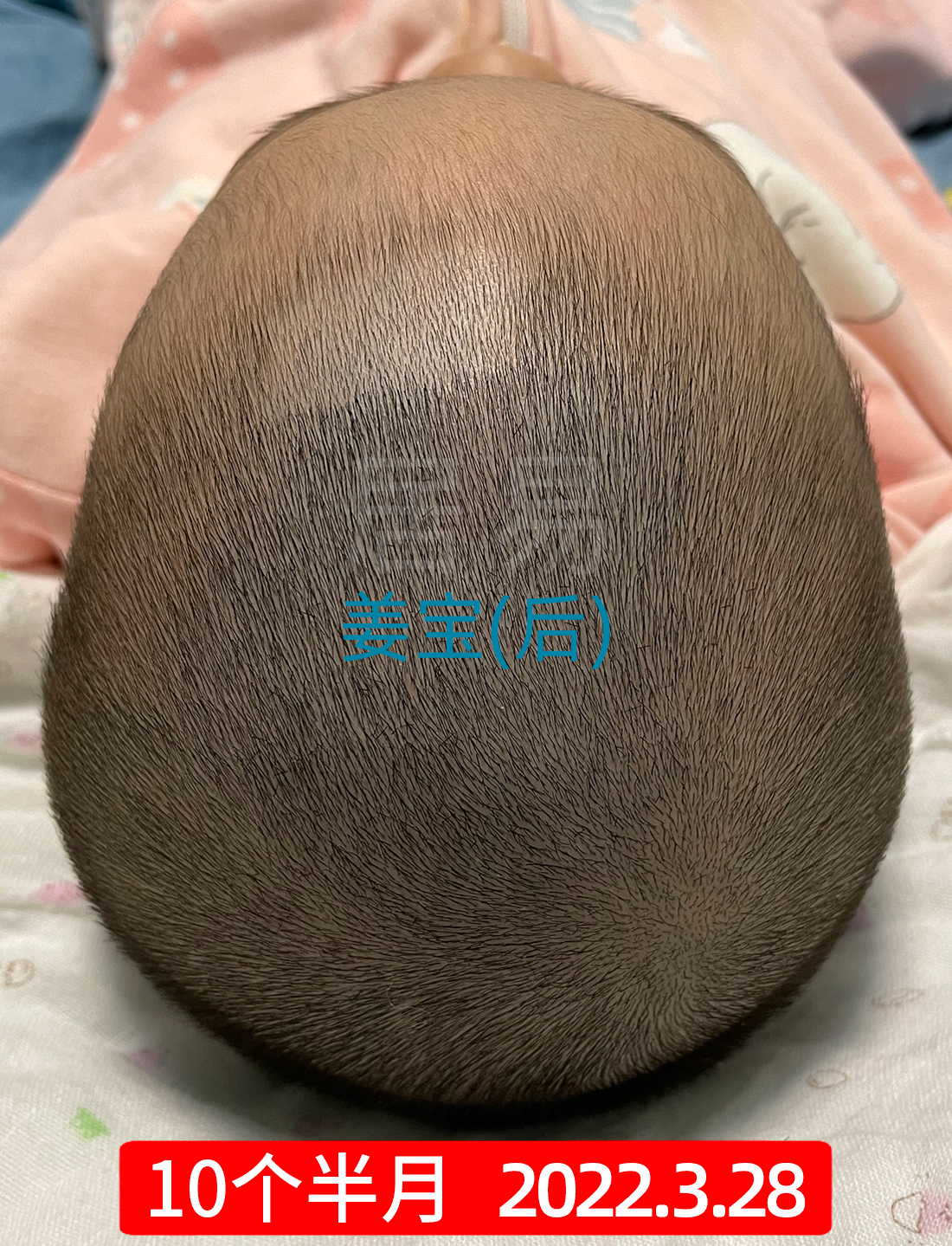 菱形头宝宝头型怎么矫正,上尖下扁头型宝宝头型怎么调整