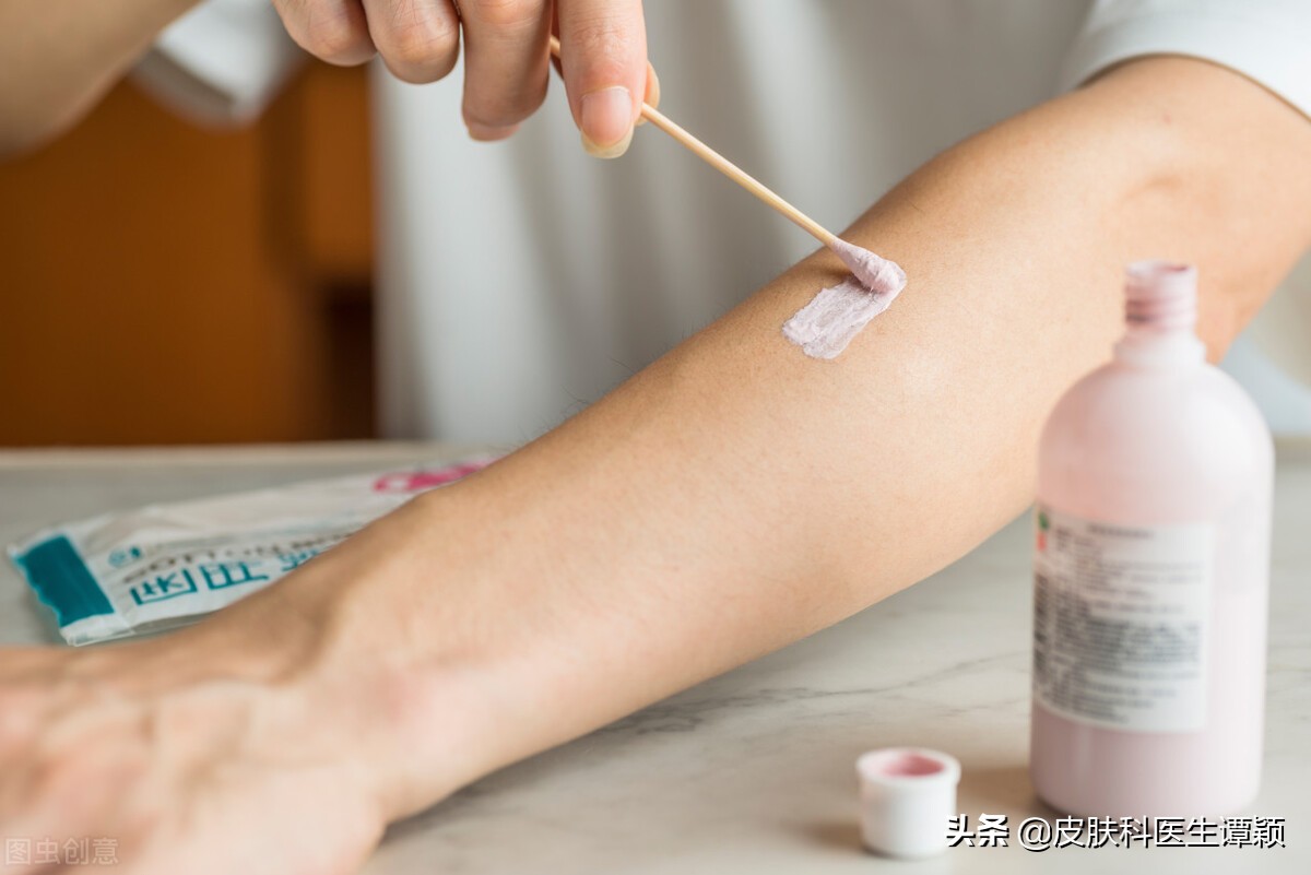 皮肤科医生和你聊聊：初夏季节，如何防治“丘疹性*麻疹荨**”？