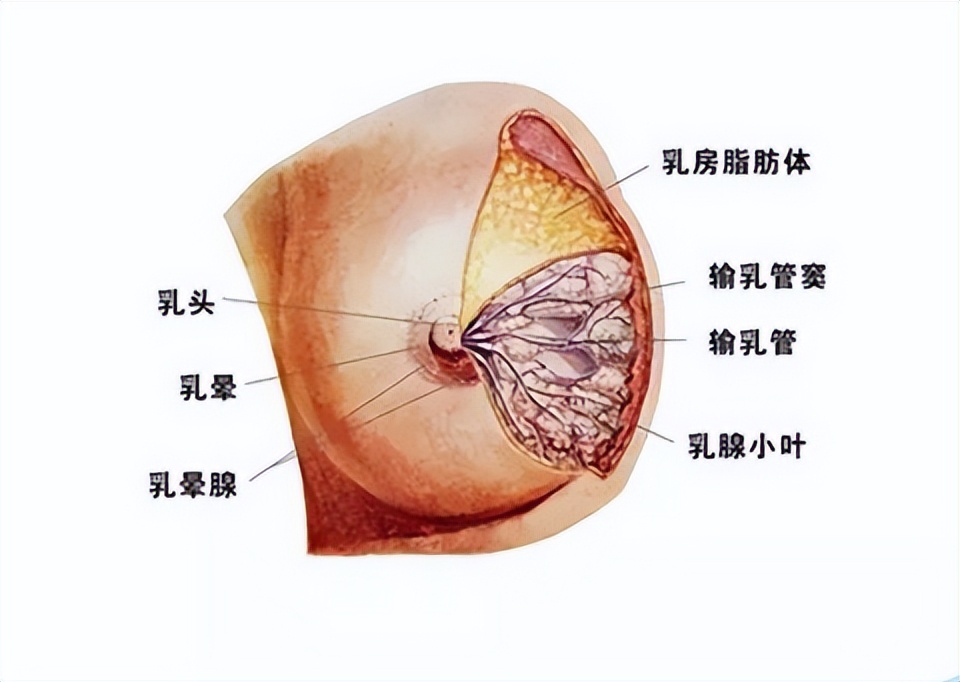 做了丰胸会导致乳腺癌吗,涂丰胸产品导致乳腺癌