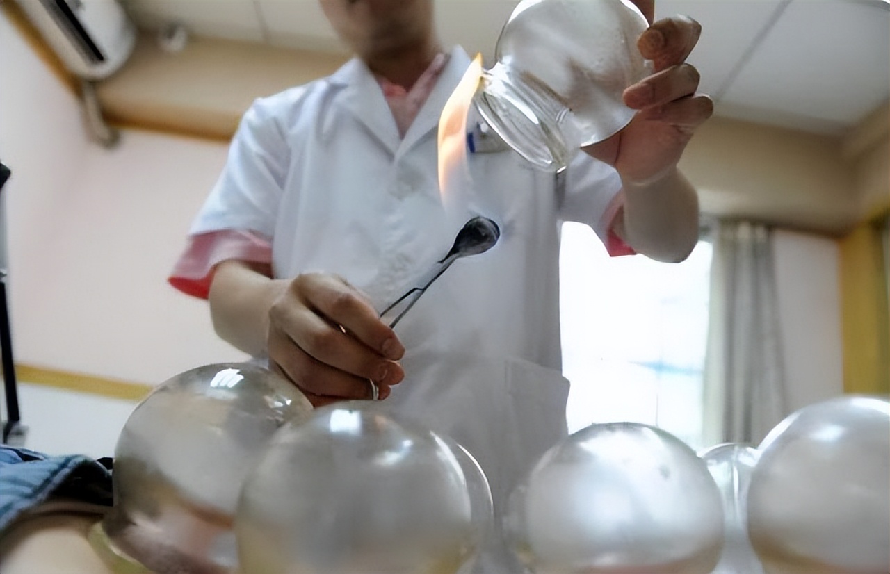 拔火罐出现的瘀血，是体内的毒素吗？