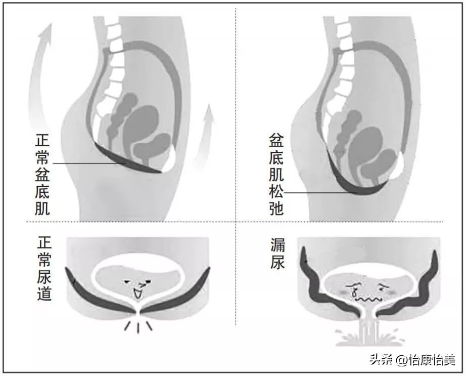 “盆底肌松”憋不住尿?这8个瑜伽体式不用跑跳,靠墙就能练!
