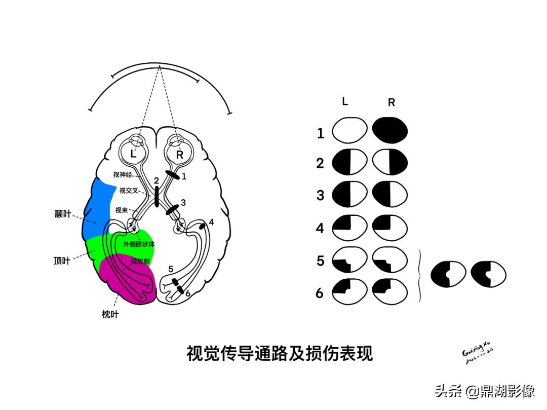 大脑皮层的解剖与定位,大脑解剖学习绘图笔记