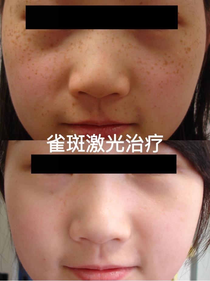 医疗美容变美秘诀,美容科医生教你悄悄变美