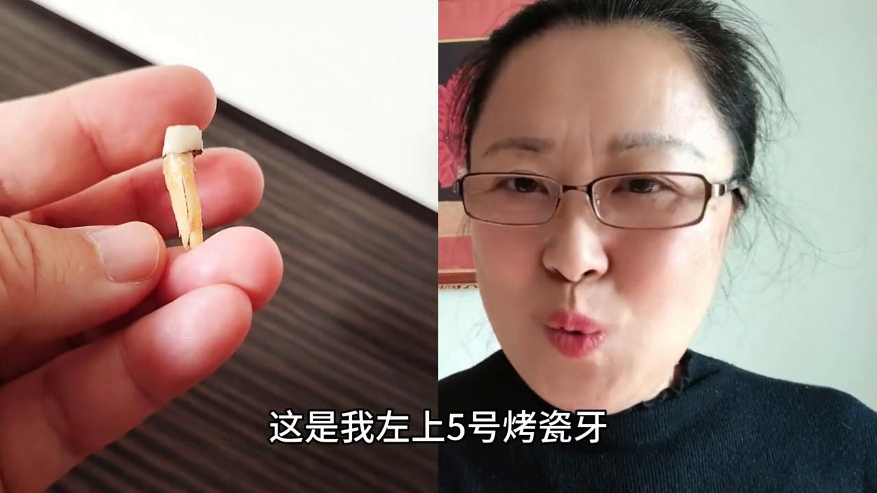 不同医院的同一品牌全瓷牙,牙齿隐裂牙神经挑好还是不挑好