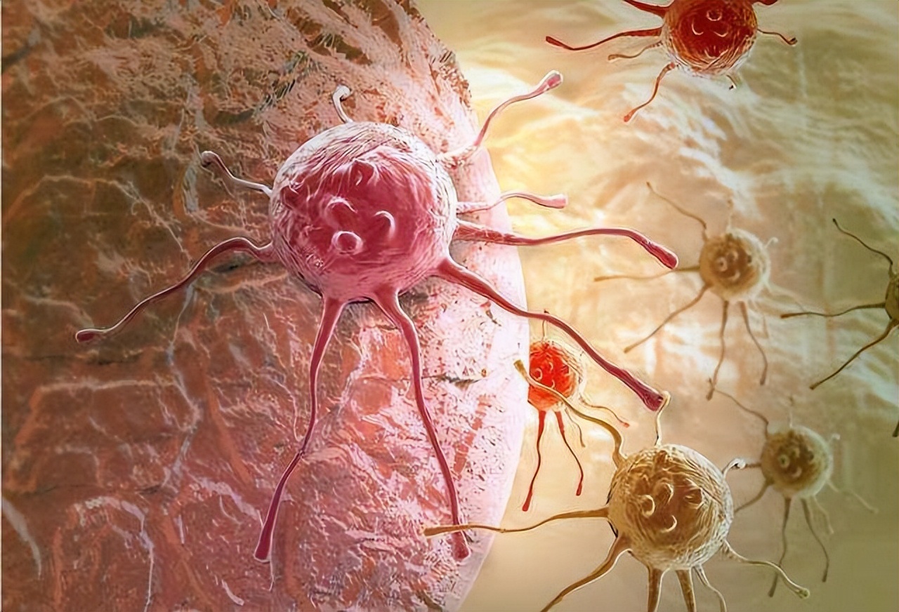 出现囊肿是什么原因引起的,出现囊肿