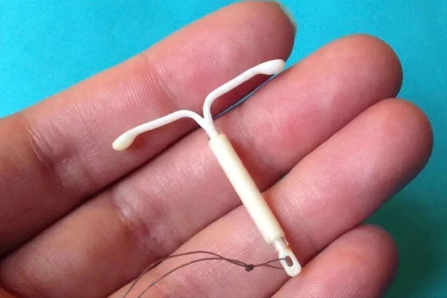 女人上环什么流程,女人上环流程