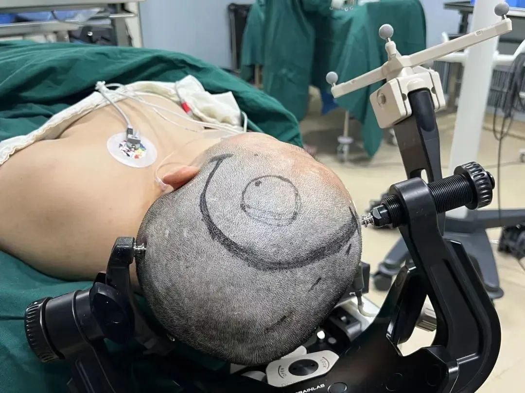 全国技术最先进的肿瘤医院,中国治愈胶质瘤的新药