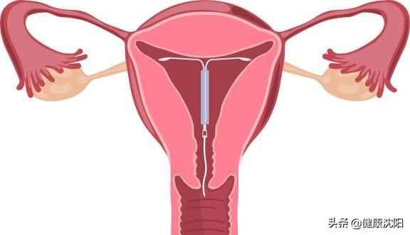 健康科普堂要注意什么,门诊人流健康宣教视频