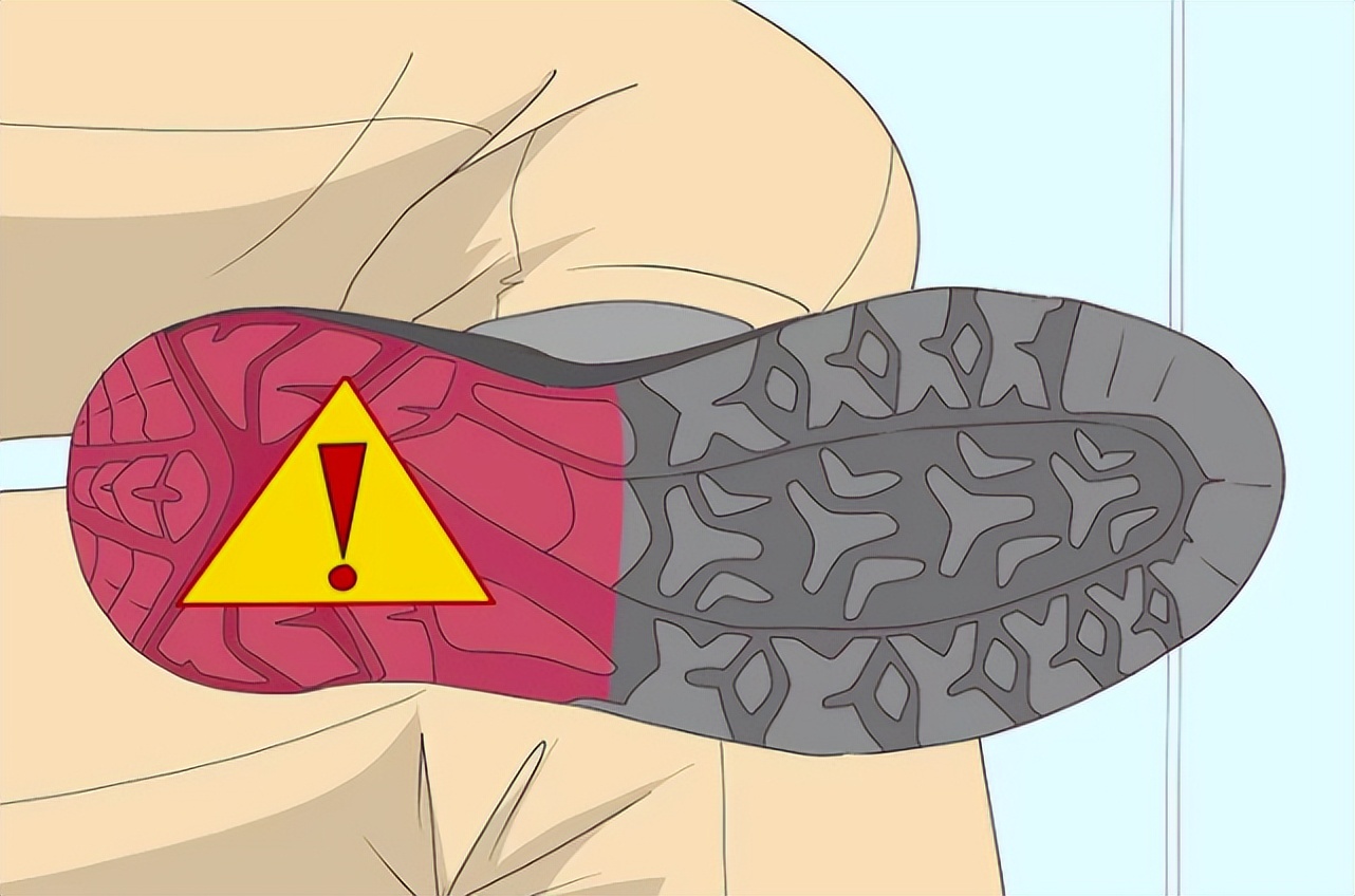 个人怎么判断跟骨内翻,如何诊断前足内翻