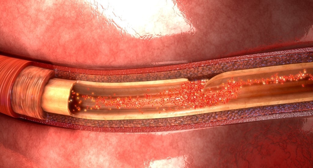 胃像饥饿一样难受是什么胃病,感觉胃不舒服又感觉好饿