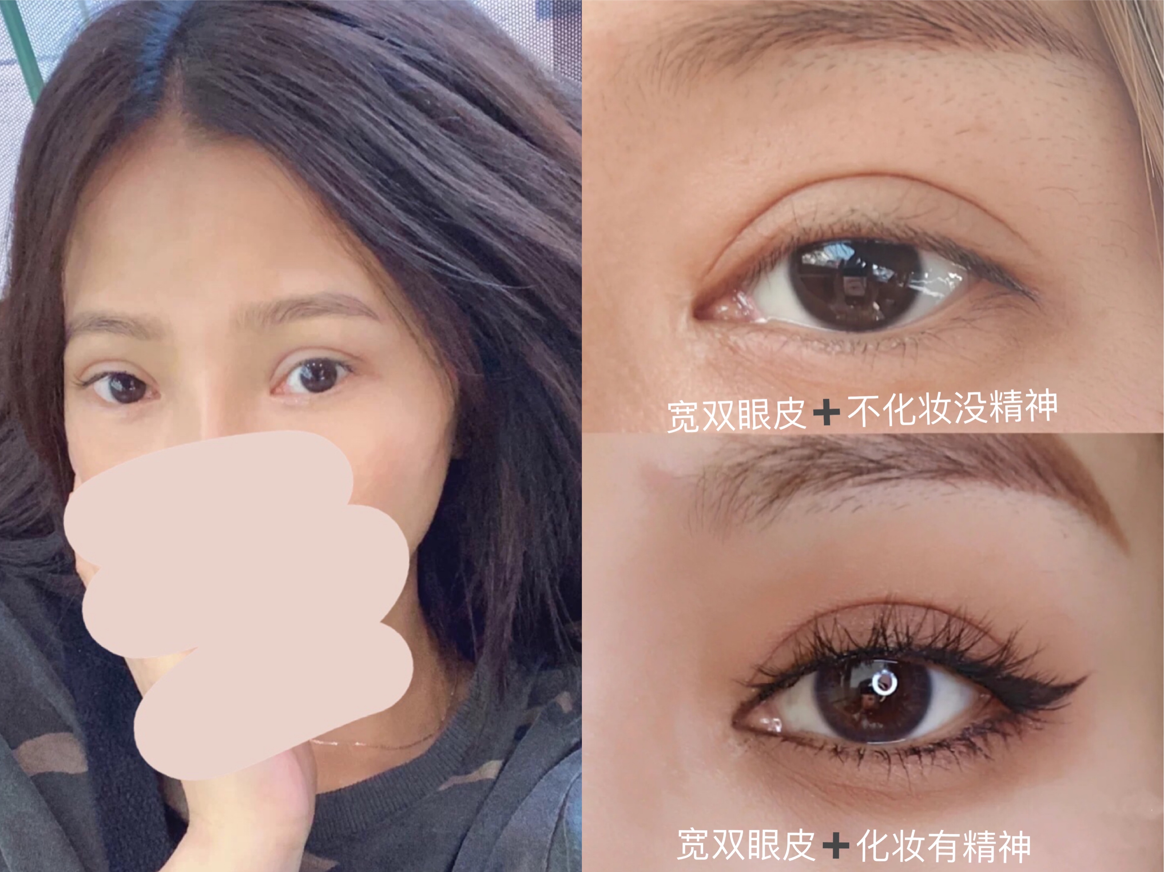 整形科普知识修复双眼皮,双眼皮整形有哪些常见方法