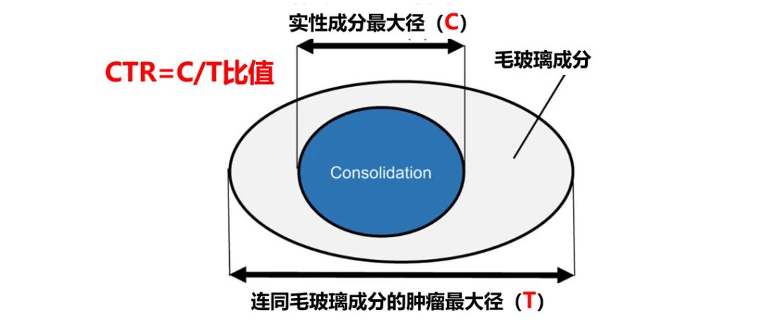 如果毛玻璃是王，那它就是王中王