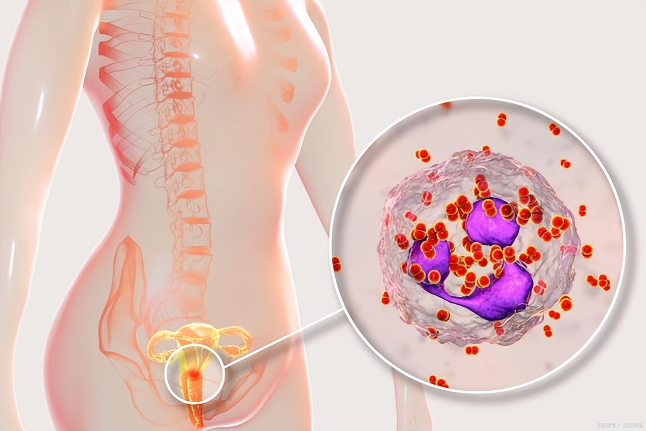 什么是淋病的临床表现,淋病的病因病机是什么