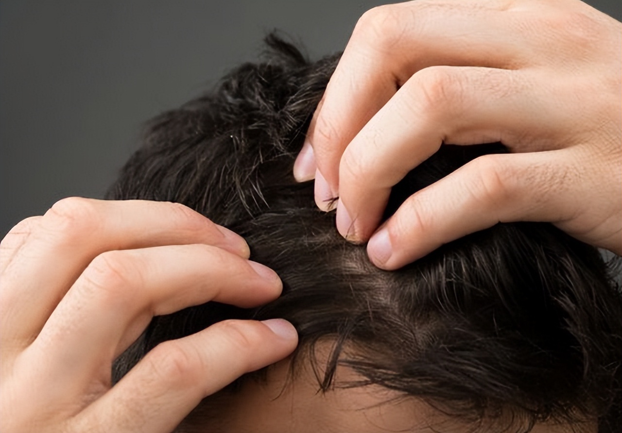 为啥头皮总长“脓包”和“疙瘩”？提示：或与这4点有关