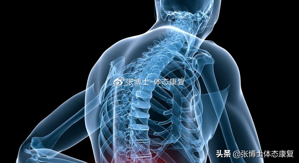 「体态康复」缓解下背痛的十六条建议