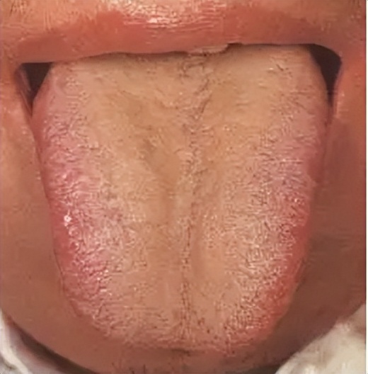 人体脾虚怎么调养,脾胃湿热和脾虚吃什么中成药