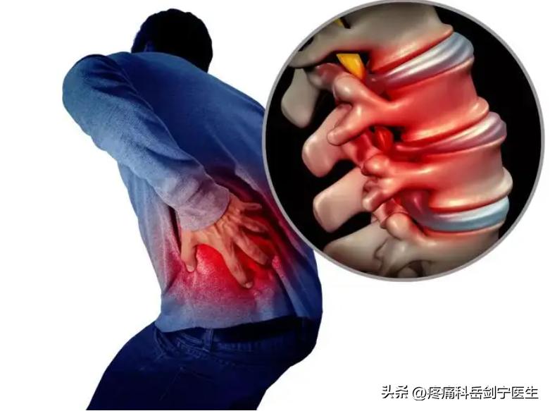 腰痛六大常见病因，看看你有没有中招