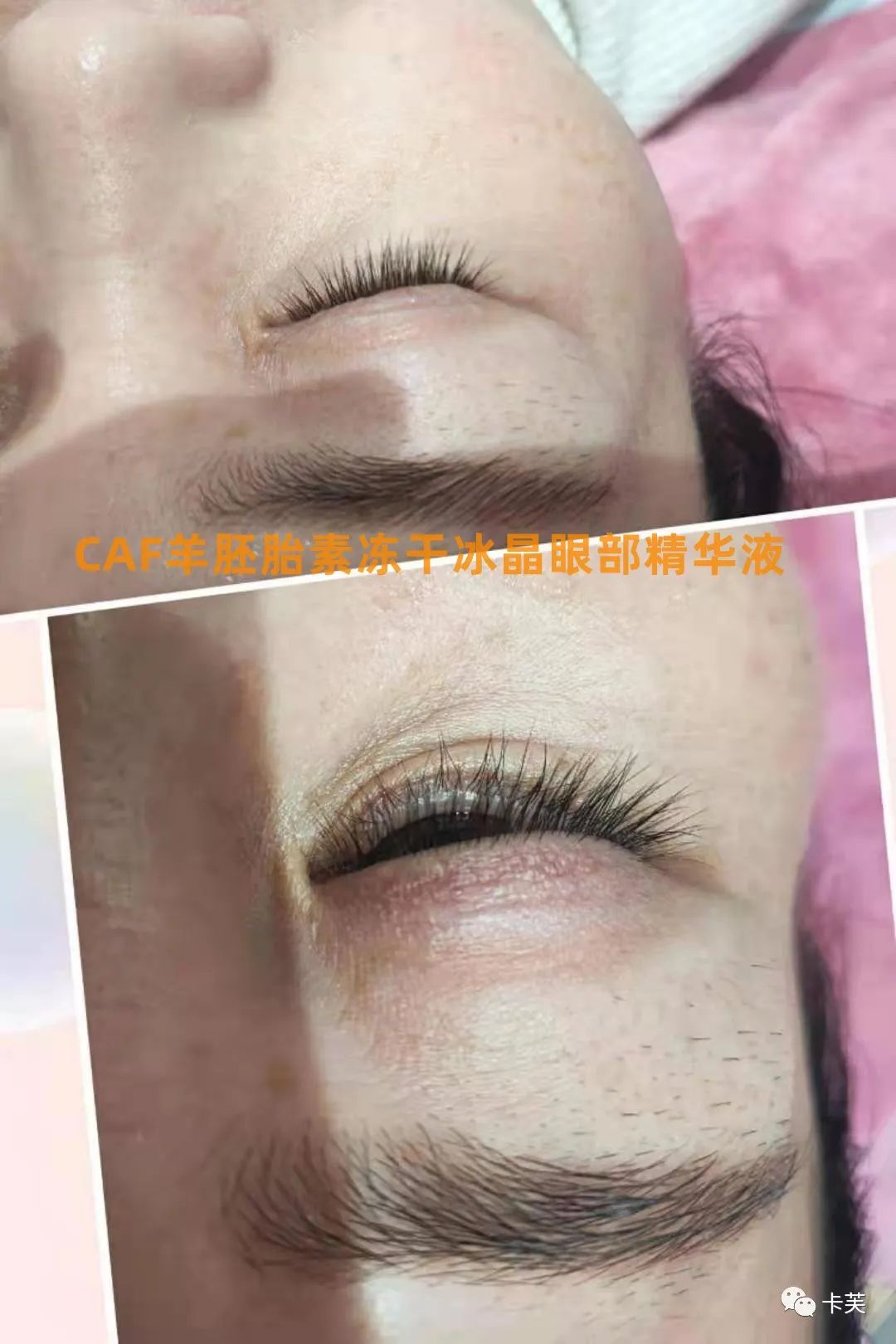 羊胚胎素冻干冰晶眼部精华液，平干纹，淡黑圈，收眼袋，美目传情