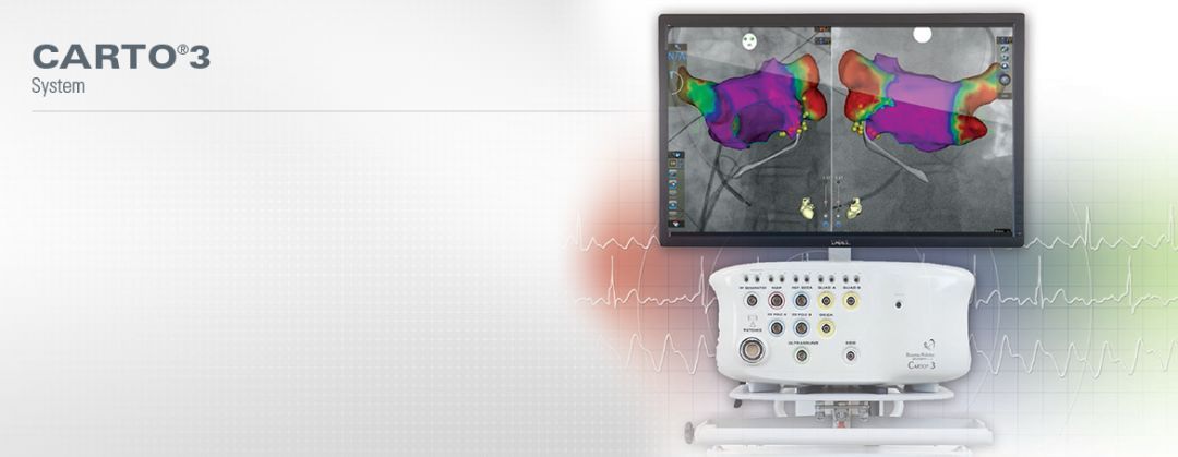 消融机器人,消融导管