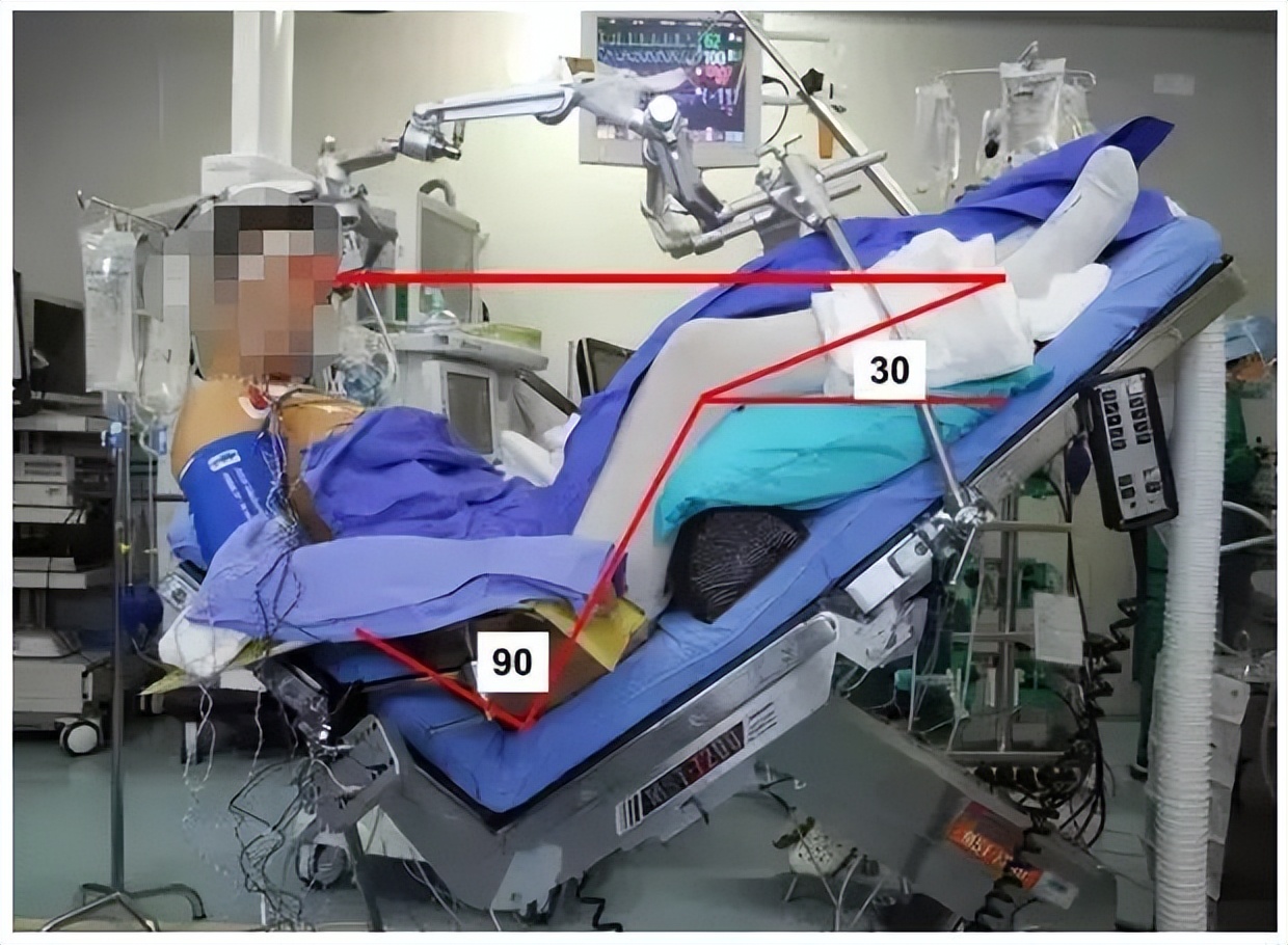 脑瘤开颅手术最佳康复方法,脑瘤开颅有多大风险