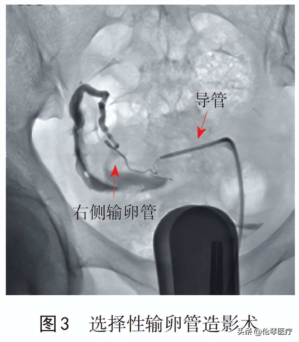 临床指南和专家共识怎么搞免费的,共识指南