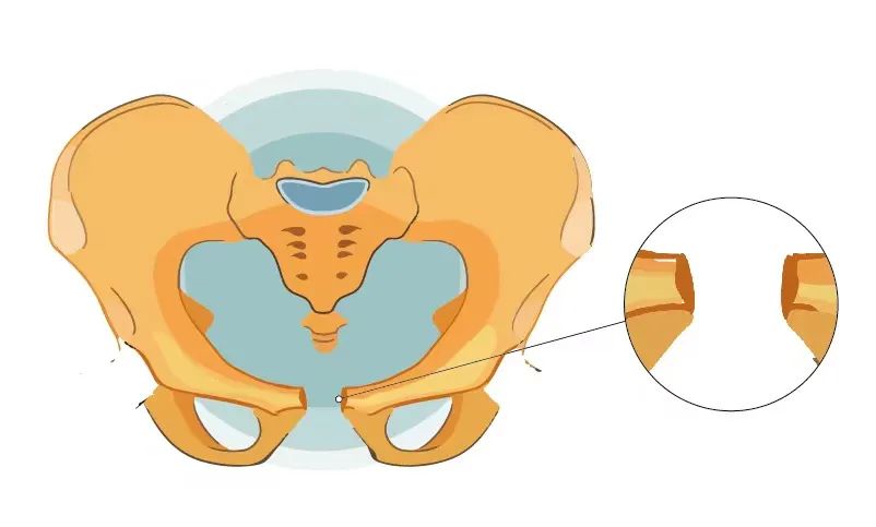 孕晚期不会耻骨痛是没有入盆吗,孕晚期耻骨痛是胎儿入盆了么
