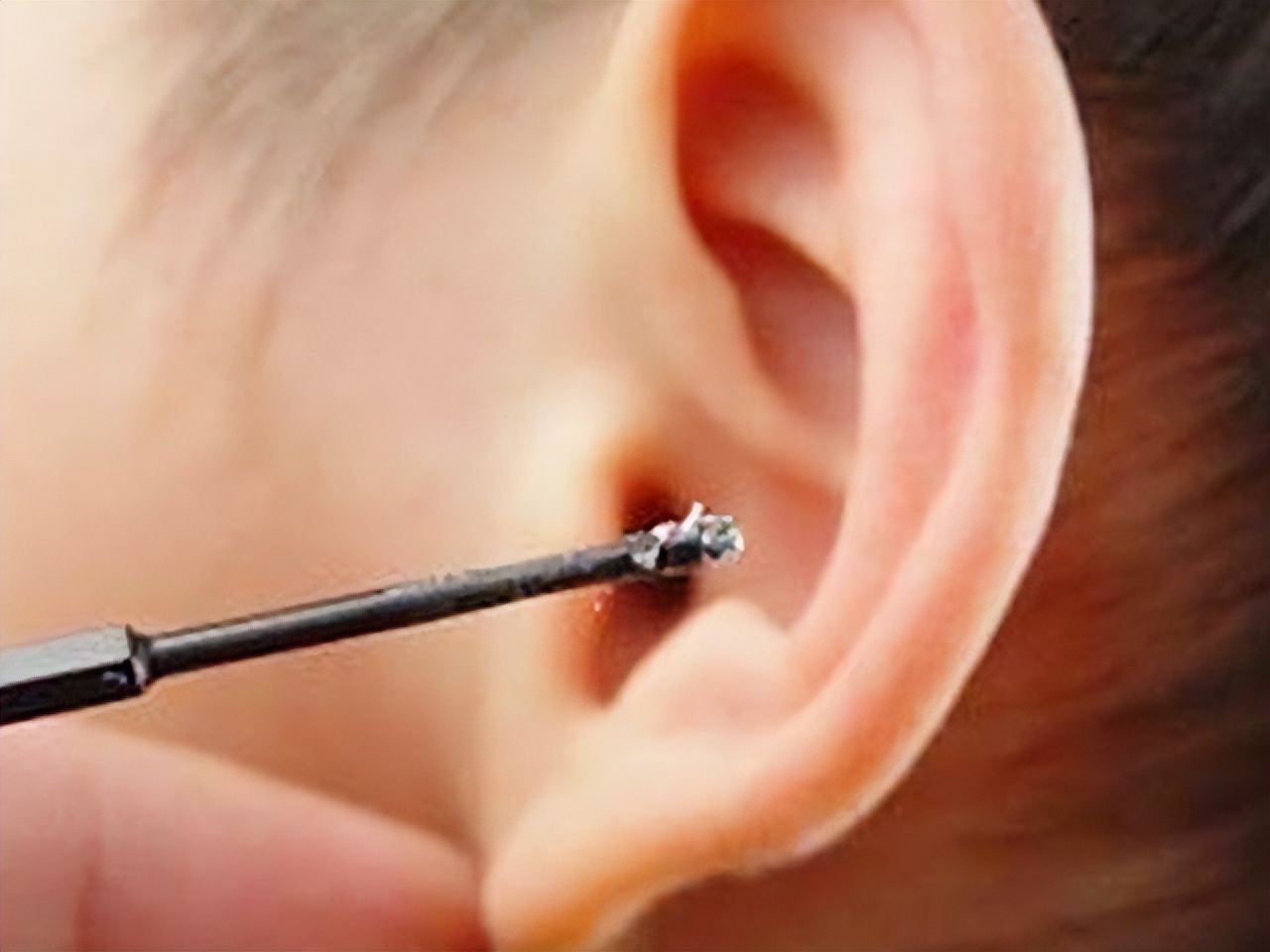 为什么有的人是油耳,糠耳与油耳的区别