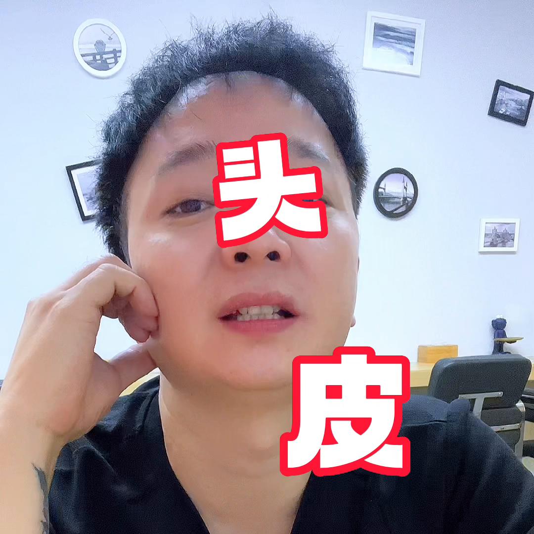 有头屑头皮痒的厉害怎么缓解,头痒头屑有什么小妙招彻底清除