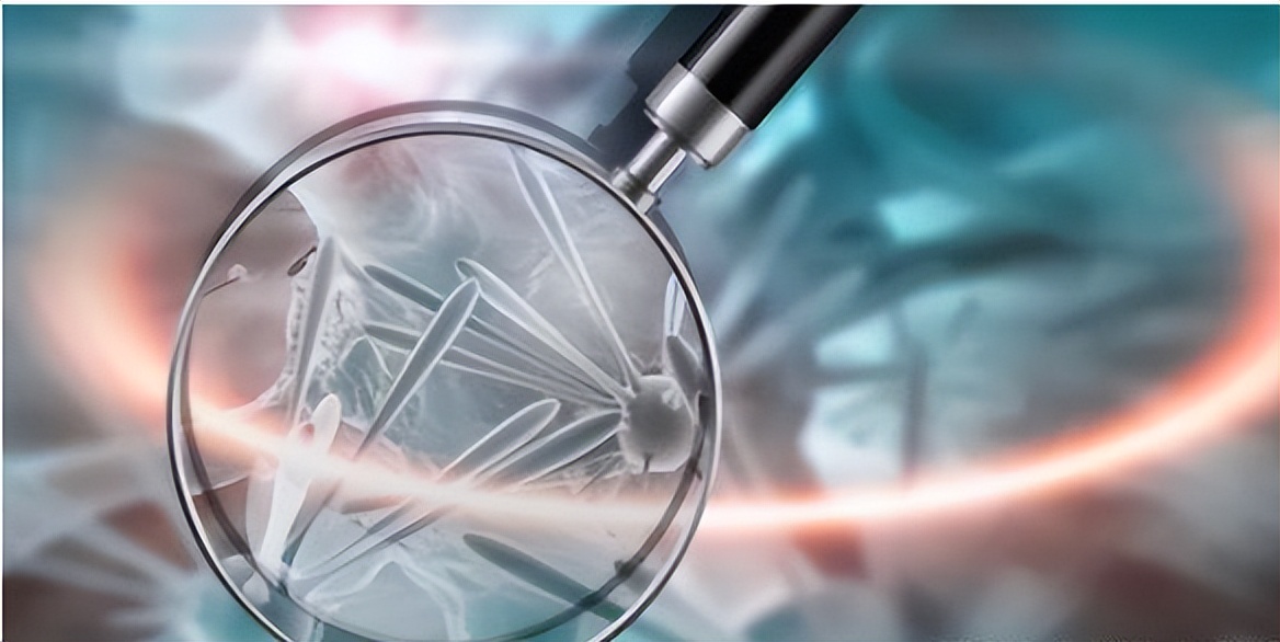 “打一针”治疗肝癌,首例国产钇90微球治疗成功,费用或仅需3万