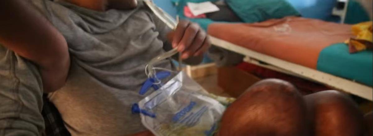 尼泊尔“卖肾村”：穷人以500美元“高价”出售，人人身上一道疤