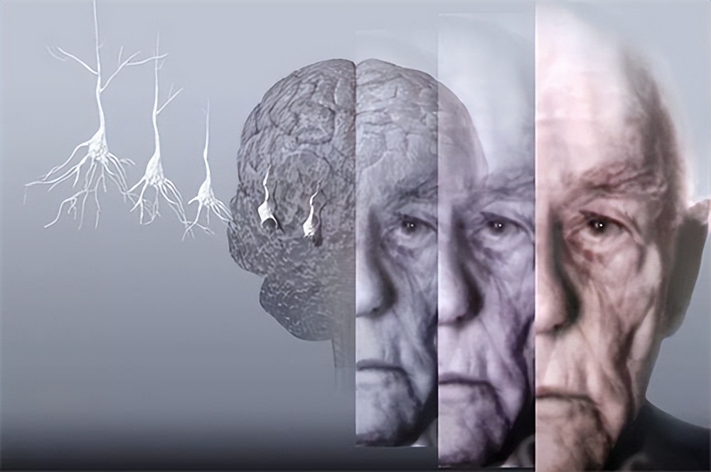 nsksd纳豆激酶中期成果,纳豆激酶日研