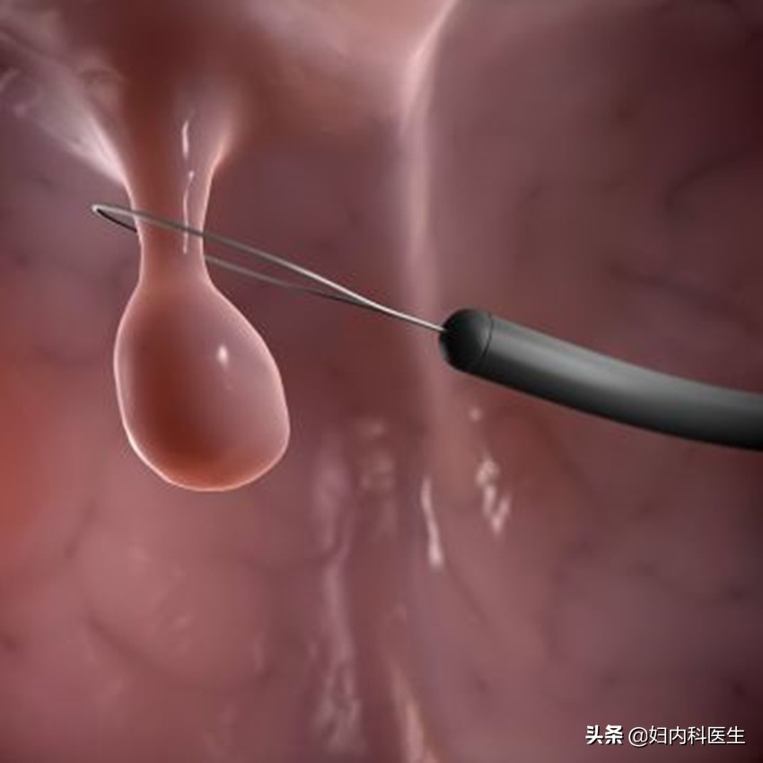 检查单上的指标怎么才能看懂？医生一文解释清楚