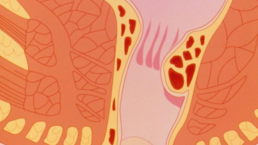 痔疮便血和肛裂便血的区别,女性痔疮肛裂便血左下腹疼