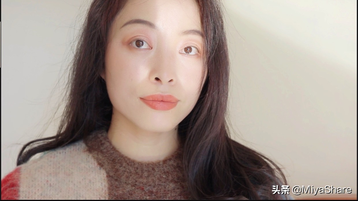 拖了一年的手术,眼袋手术5年后的感受