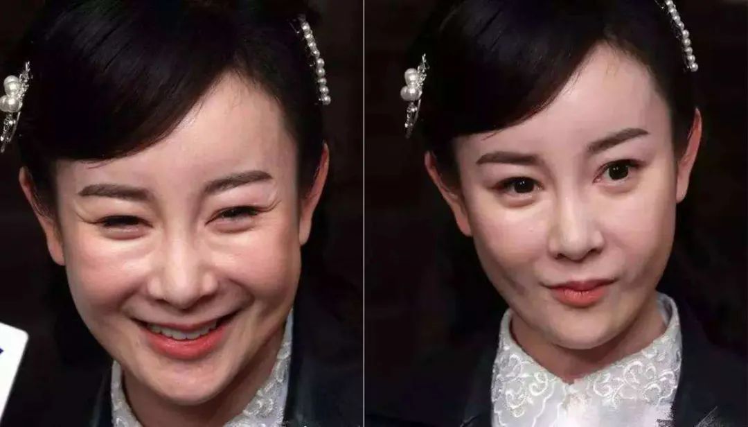 知道它的人不多，但四五十岁女性用了真的能淡纹，值得一看