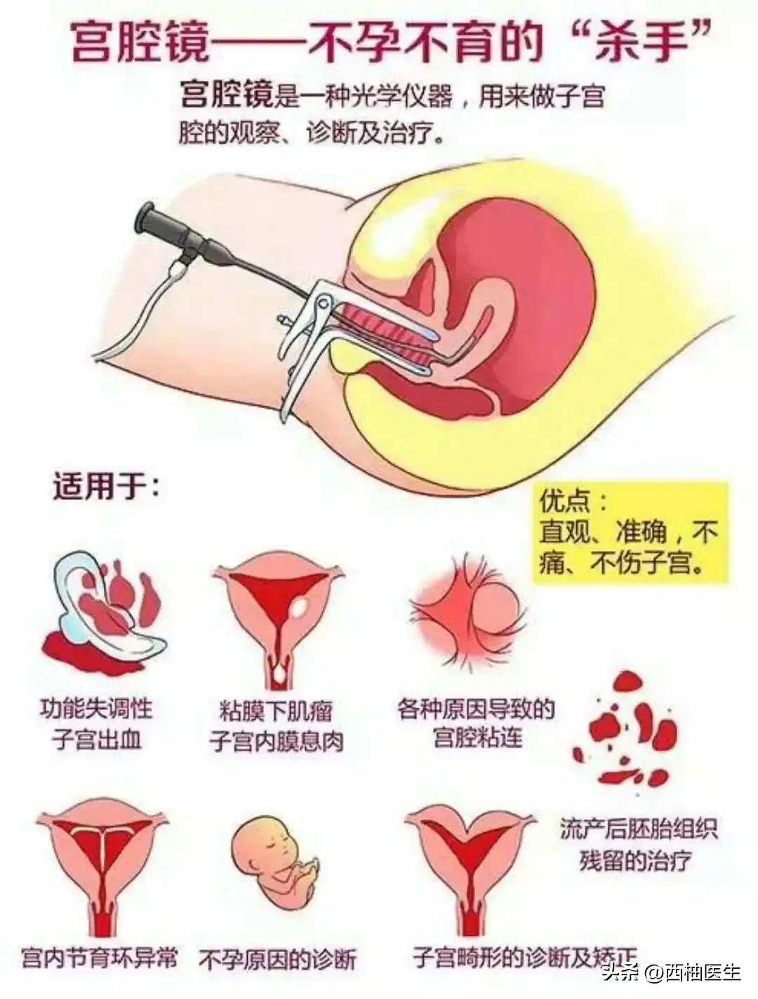 宫腔镜手术前需要做哪些检查项目,做宫腔镜检查需要打麻醉药吗