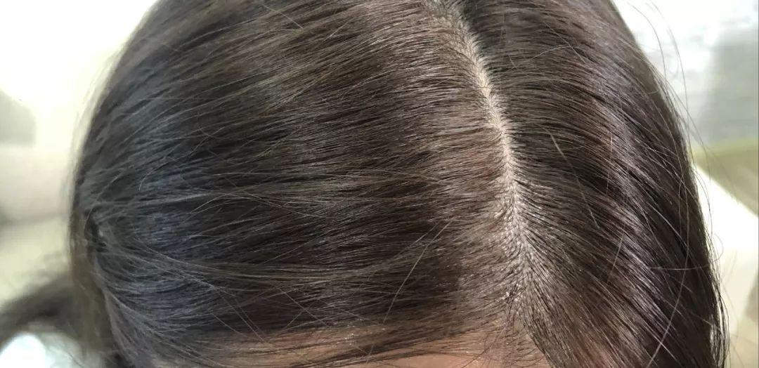 海飞丝清扬阿道夫洗发水哪个更好,洗发水是清扬的好还是海飞丝的好