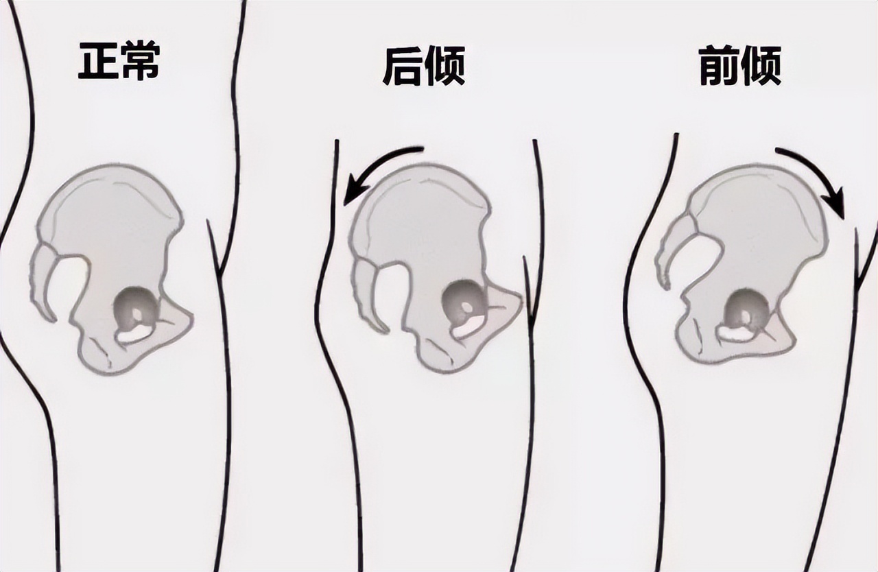 所有怀孕女性最该上的一课，别因为羞于启齿毁掉自己的身体