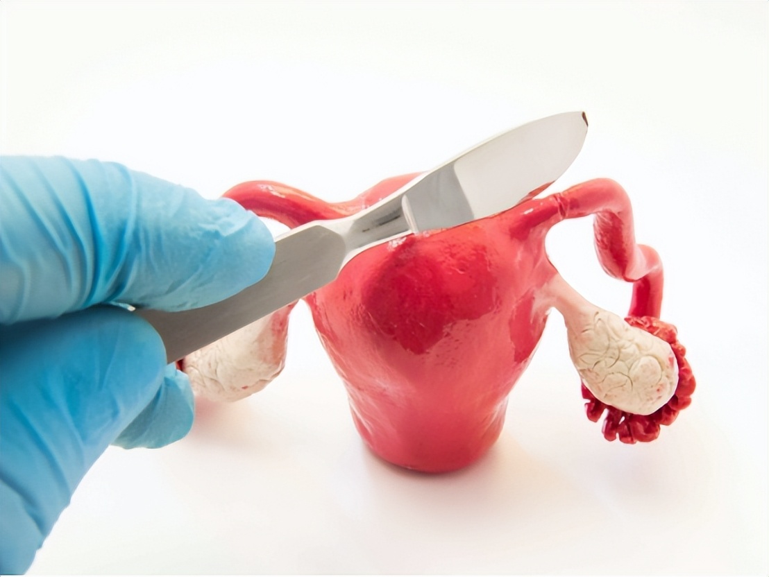 女性没了子宫，会影响“行事”？医生坦言：满意度反而提高了