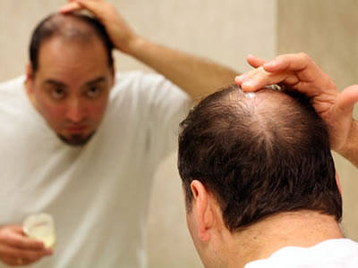 这些生发误区你还在做吗,这些防脱发产品你值得拥有