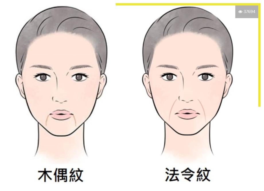 脸上有印第安纹法令纹怎么办,脸上法令纹怎么中医药改善