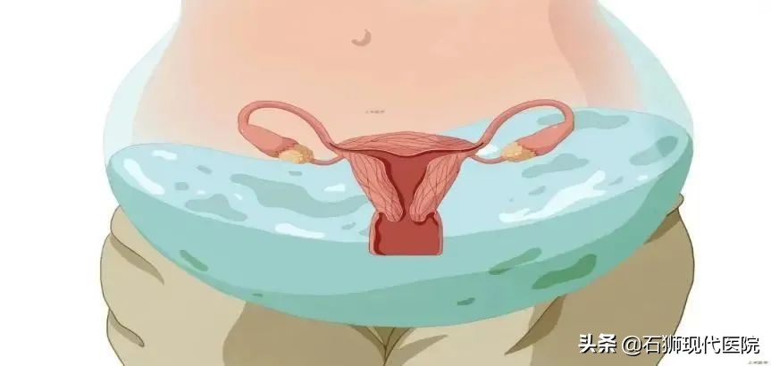 48岁的女人妇科体检应该做哪几项,妇科检查怎么查