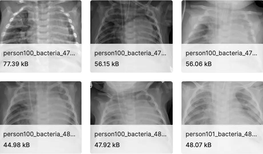 60+开源数据集资源大合集（医学图像、卫星图像、自动驾驶等）