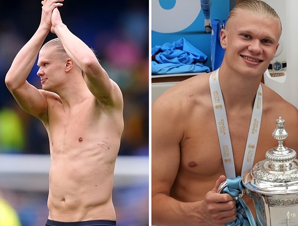 哈兰德身材对比姆巴佩,哈兰德有多强壮