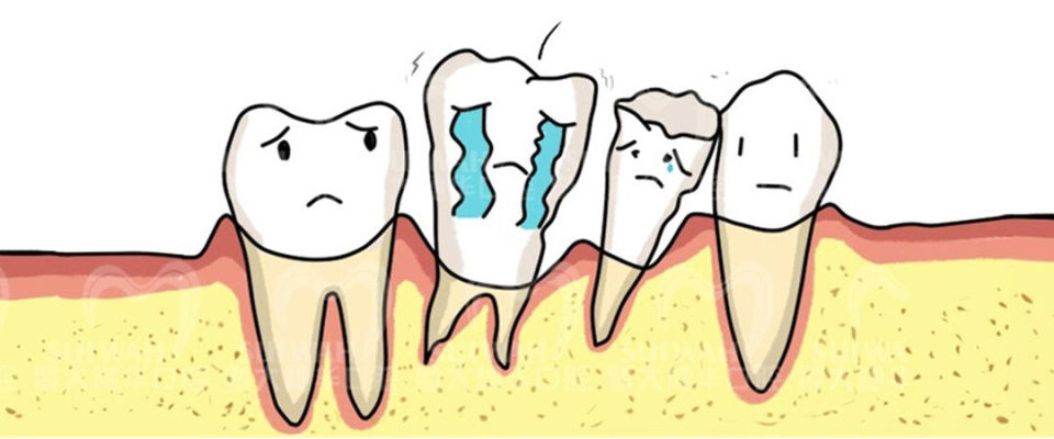 牙疼怎么辨别是哪种牙病,牙疼怎么判断是上火还是有炎症
