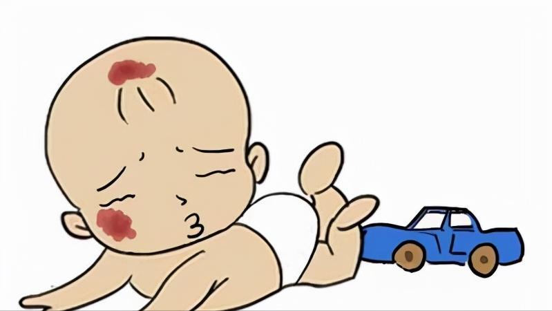 孩子身上的胎记是血管瘤吗,儿童面部红斑胎记